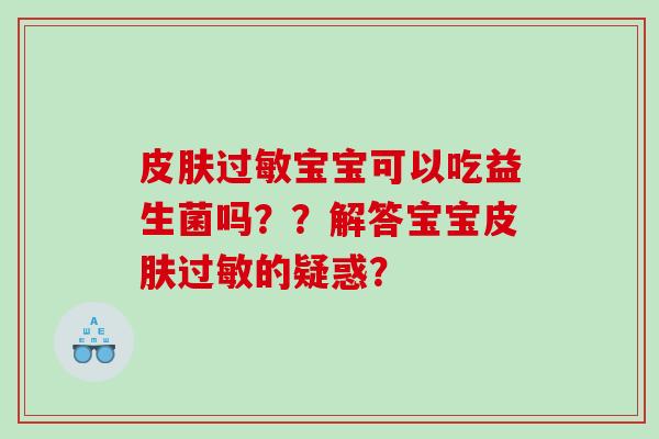 宝宝可以吃益生菌吗??解答宝宝的疑惑? 宝宝可以吃益生菌吗??解答宝宝的疑惑?