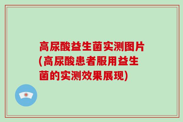 高尿酸益生菌实测图片(高尿酸患者服用益生菌的实测效果展现)