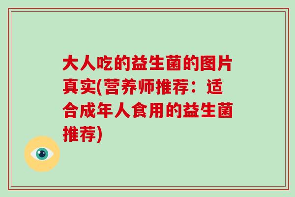 大人吃的益生菌的图片真实(营养师推荐：适合成年人食用的益生菌推荐)