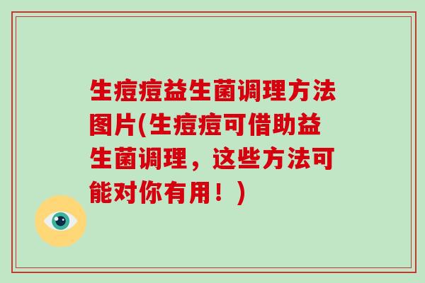 生痘痘益生菌调理方法图片(生痘痘可借助益生菌调理,这些方法可能对你有用!) 生痘痘益生菌调理方法图片(生痘痘可借助益生菌调理,这些方法可能对你有用!)