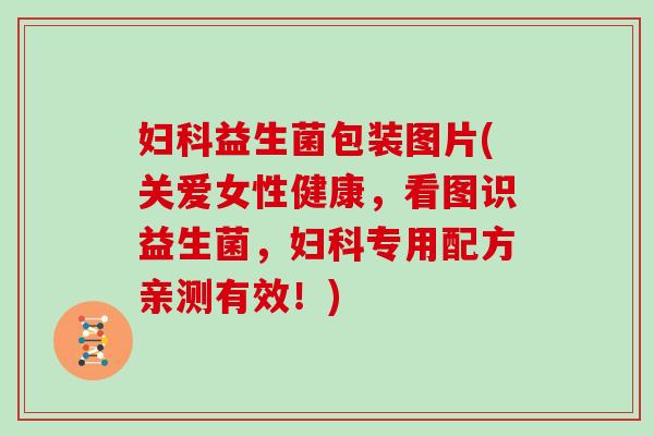 妇科益生菌包装图片(关爱女性健康，看图识益生菌，妇科专用配方亲测有效！)
