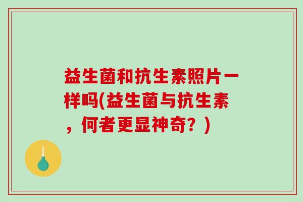 益生菌和抗生素照片一样吗(益生菌与抗生素，何者更显神奇？)
